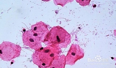 口臭的原因和治疗方法