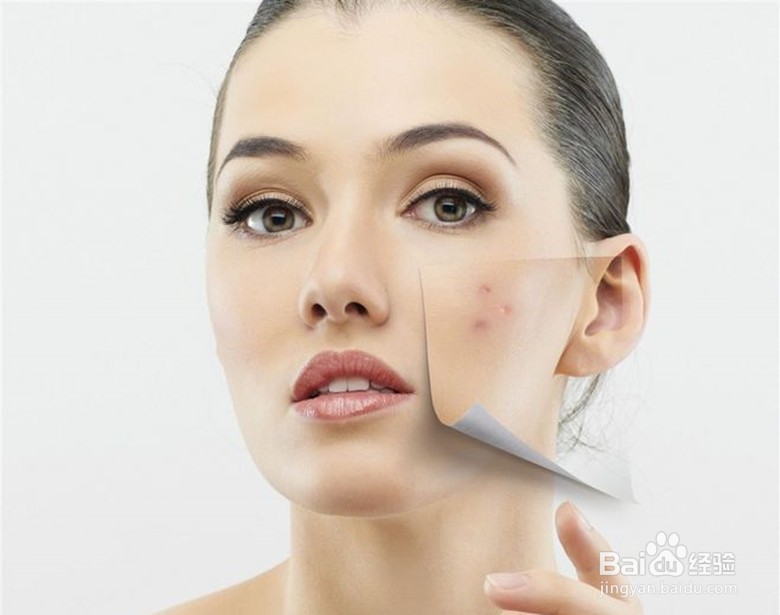 皮肤深层痘菌怎么清除