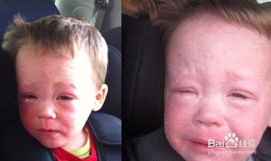 过敏性体质怎么办