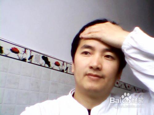 脸上皮肤干燥的自然疗法