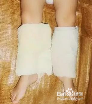 【图解急救法】几个退烧的好办法！（力荐）