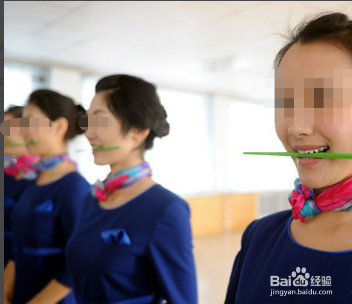 笑露牙龈怎么矫正