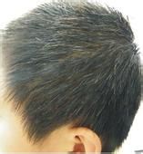 医用小知识，用得上。