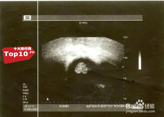 盘点十大奇葩有趣的心形物体