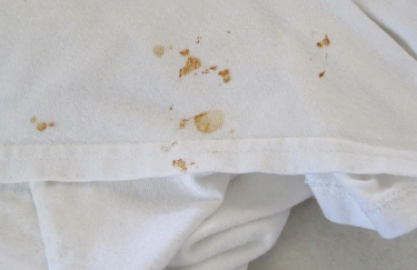 白衣服上有铁锈怎么才能清洗掉