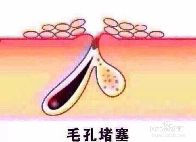 清洗毛孔怎么做，怎么清洁毛孔？