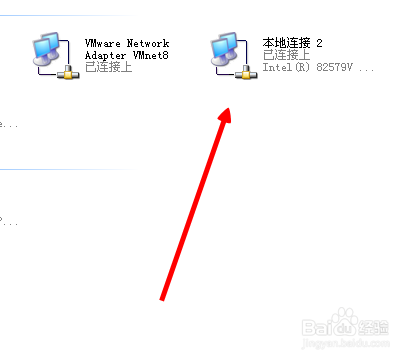 本地连接怎么自动获取IP
