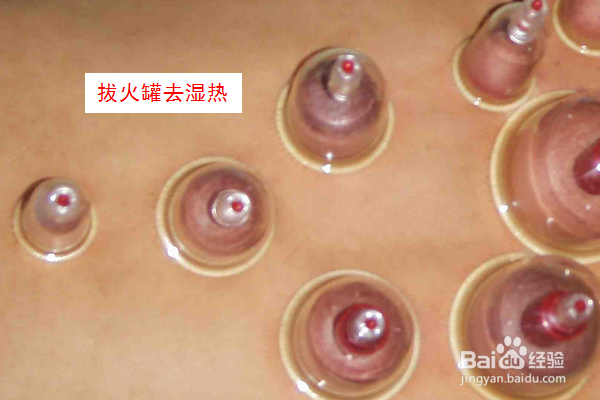 哪些姿势对腰部有损伤？如何护腰？