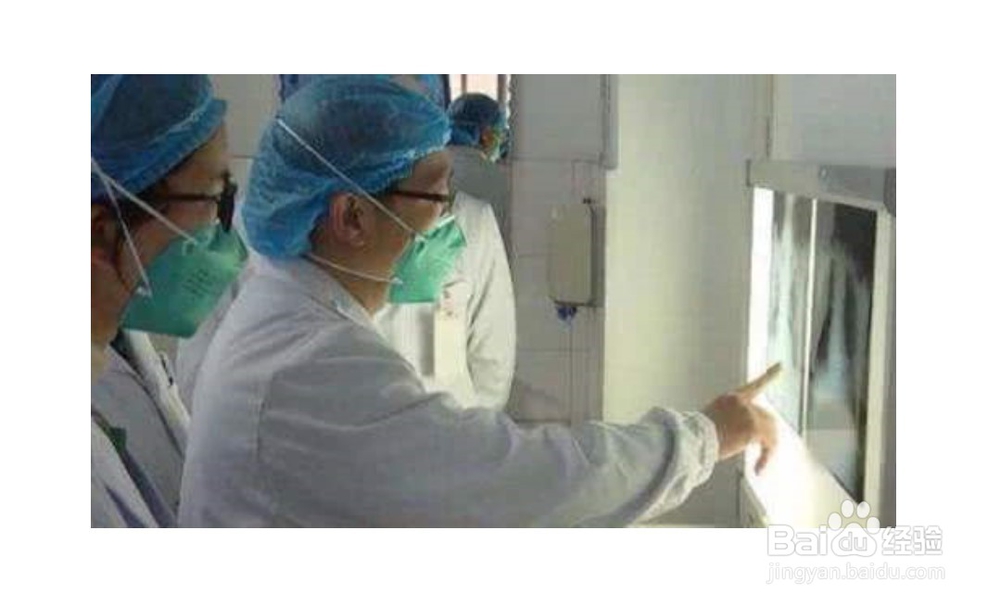 冠状肺炎有什么症状？