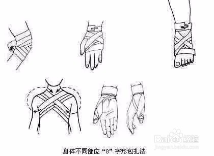 户外受伤如何正确地处理包扎