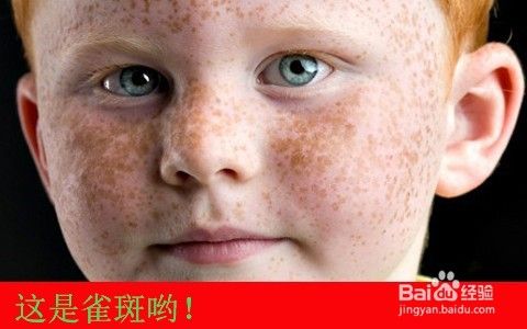 点斑水效果好吗 药水点雀斑管用吗 百度经验