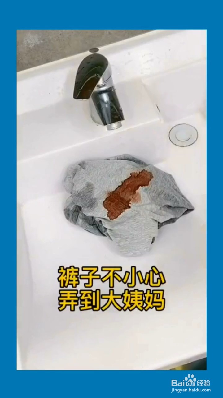 如何清洗裤子上的血迹?