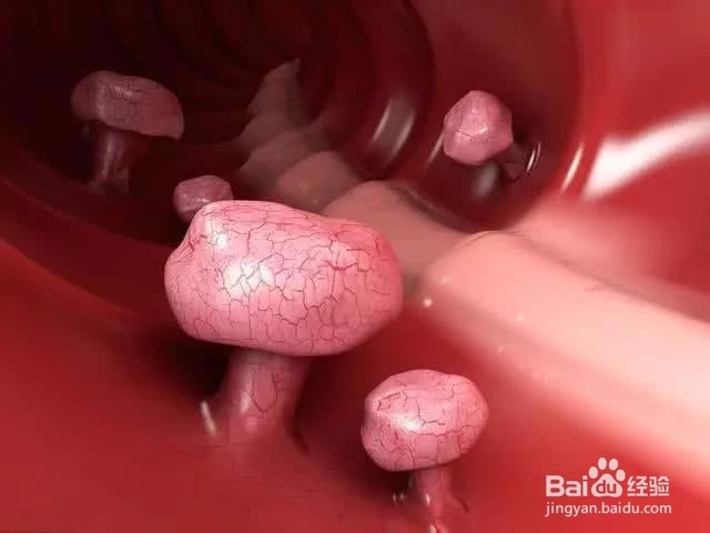 身体出现3多2痛 趁早就医