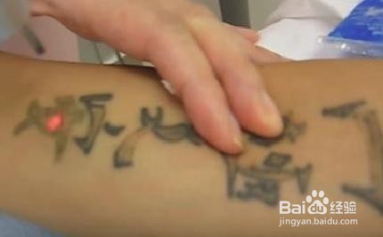 如何用自然方法去除纹身