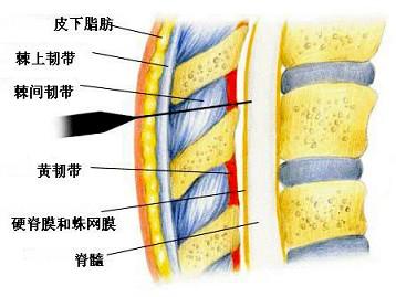 齿状韧带由什么形成