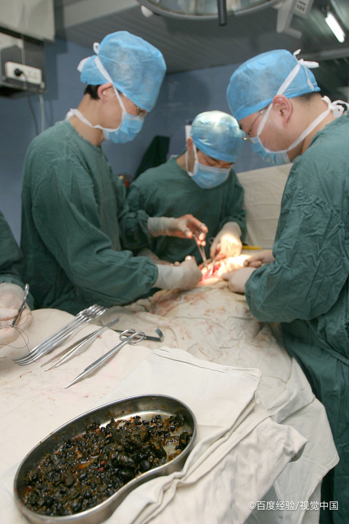 孕期有了结石还补钙吗？