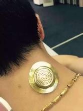 艾针灸如何治疗感冒