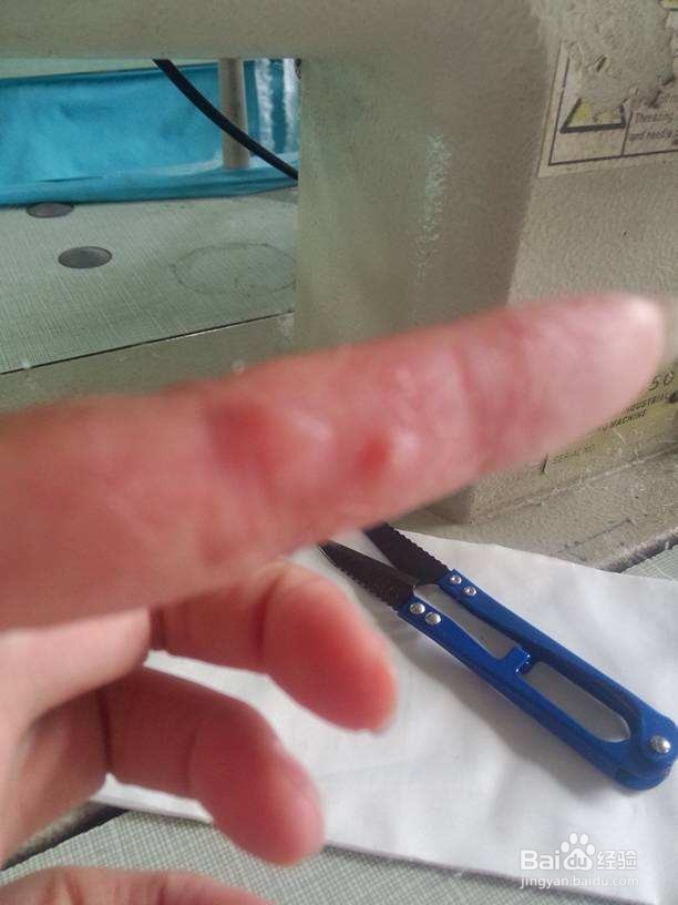 手部怎么防止感染。