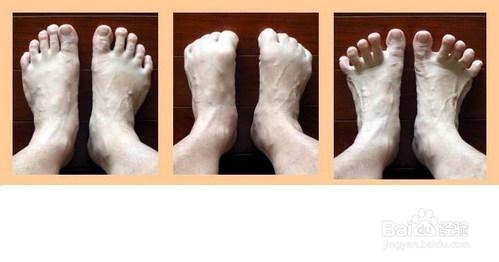 踝关节运动损伤的恢复训练