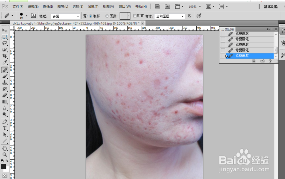 怎么用ps清除图片上的污点 痘痘
