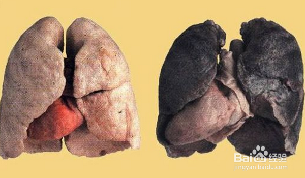 怎样快速戒烟（成功永久戒烟好方法）