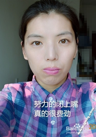牙齿矫正：[2]带牙套的第二天的感受
