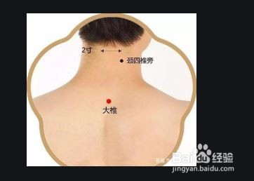 感冒了在家怎样处理