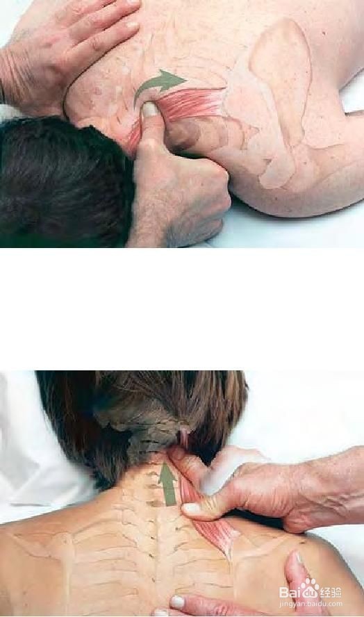 如何缓解颈椎病初期的疼痛？