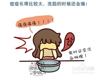 脸上长痘痘注意事项