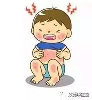 气温骤降,谨防皮肤冻伤!