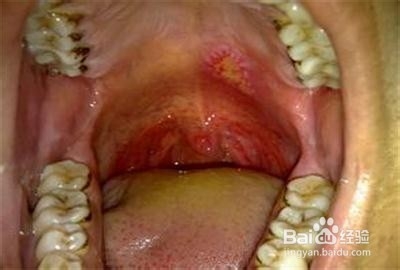 适合夏季养生食用的粥：[2]