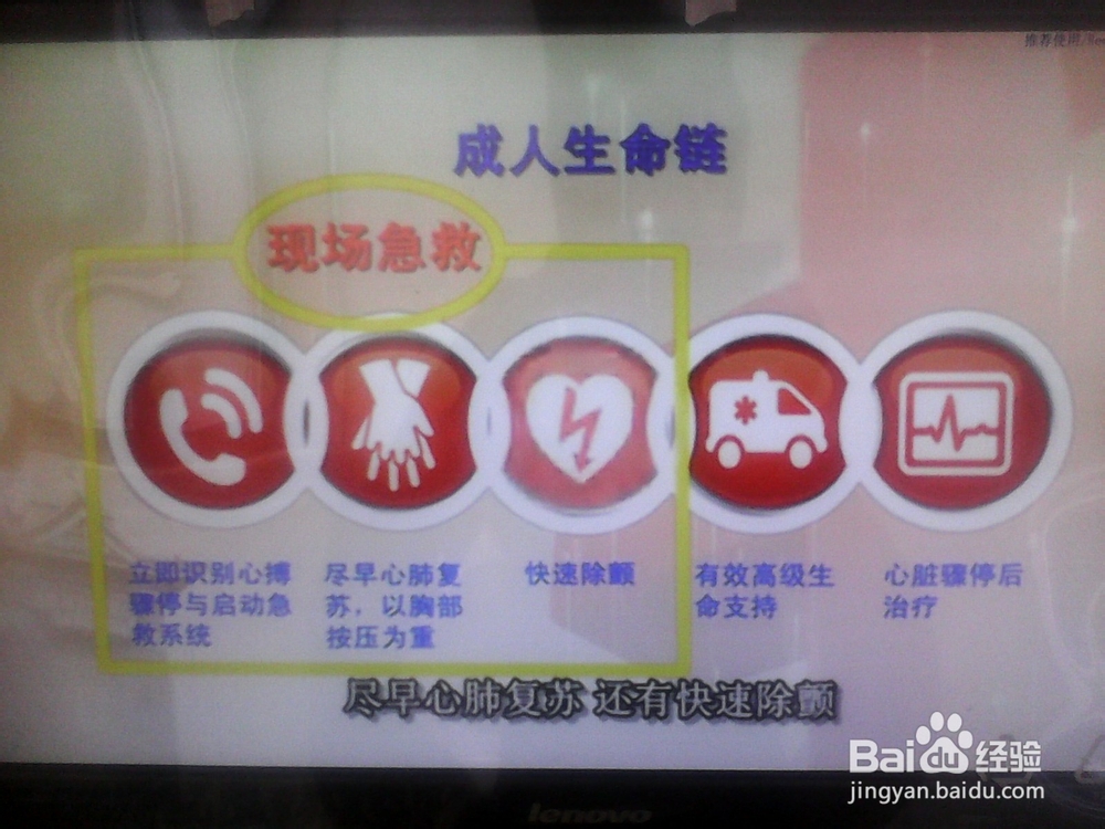 心脏骤停的现场急救