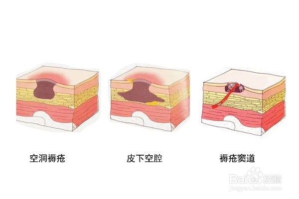 油纱条制作方法和步骤