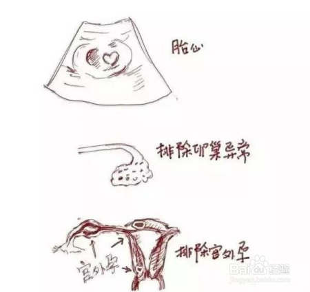 孕期做阴超会伤害到宝宝吗能不能改做腹超