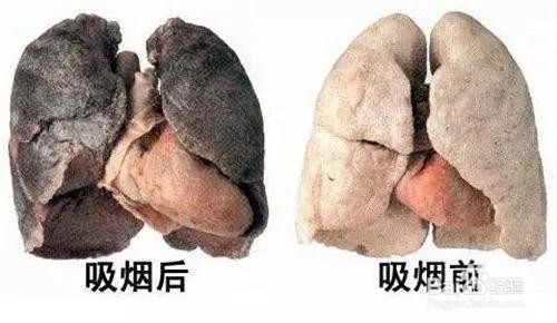 如何戒除烟瘾呢?