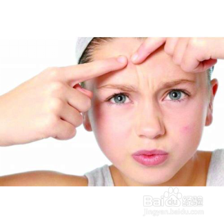 三种降火祛痘效果极佳的传统方法