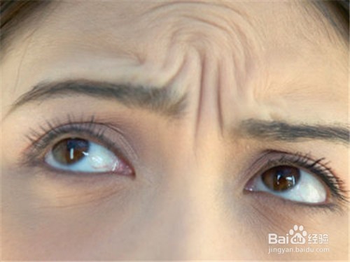 6个方法去除抬头纹，让额头重新恢复神采！