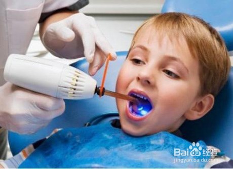 小儿牙齿保健