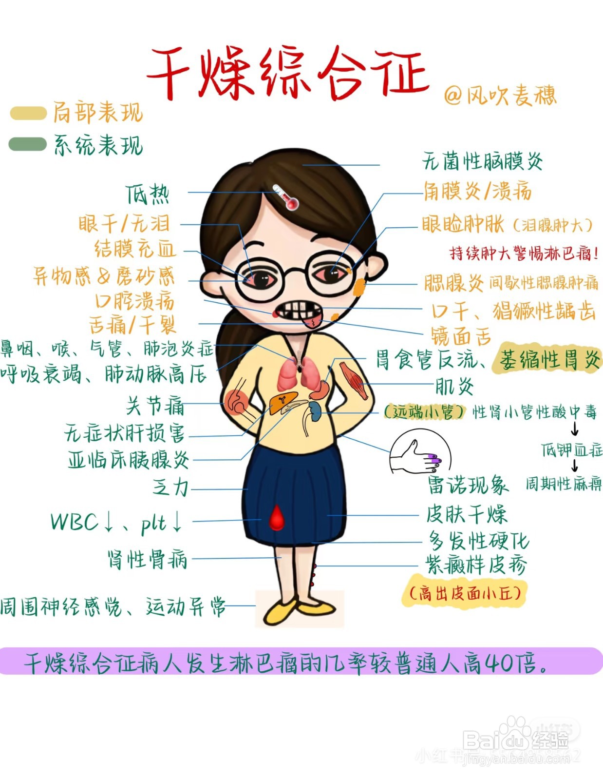 如何治疗干燥综合症