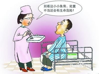 鱼刺卡在喉咙里的急救措施
