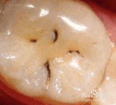 了解一下那些被忽视的身体病状