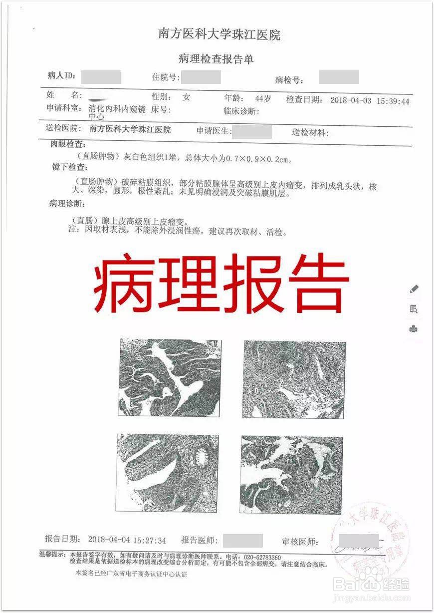 水滴保险怎么报销