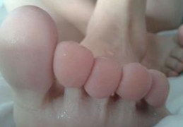 脚出汗多怎么办