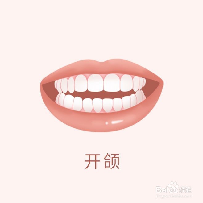 牙齿矫正类型