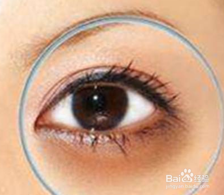 黑眼圈怎么去除最快