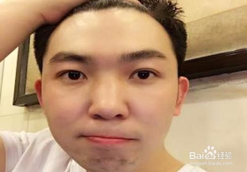 男生该如何护肤