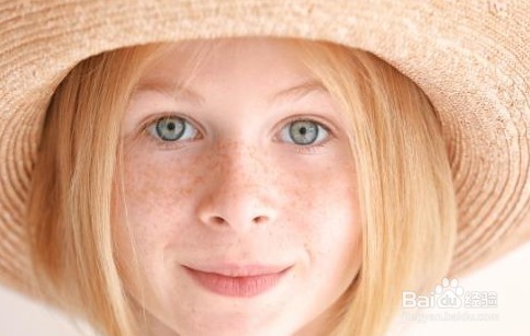 雀斑如何防治与清除