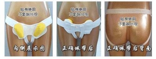 怎么使用疝气带