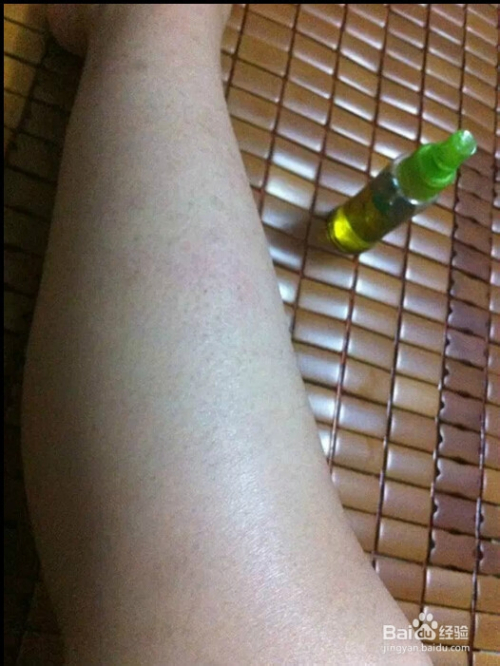 鸡皮肤蛇鳞纹(鸡皮肤蛇鳞纹怎么办) 鸡皮肤蛇鳞纹(鸡皮肤蛇鳞纹怎么办)