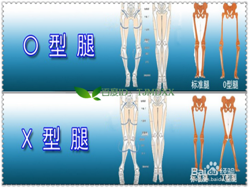 生活/家居 > 生活常識 1 人的腿型分類: 我們人的腿型總得來說有以下